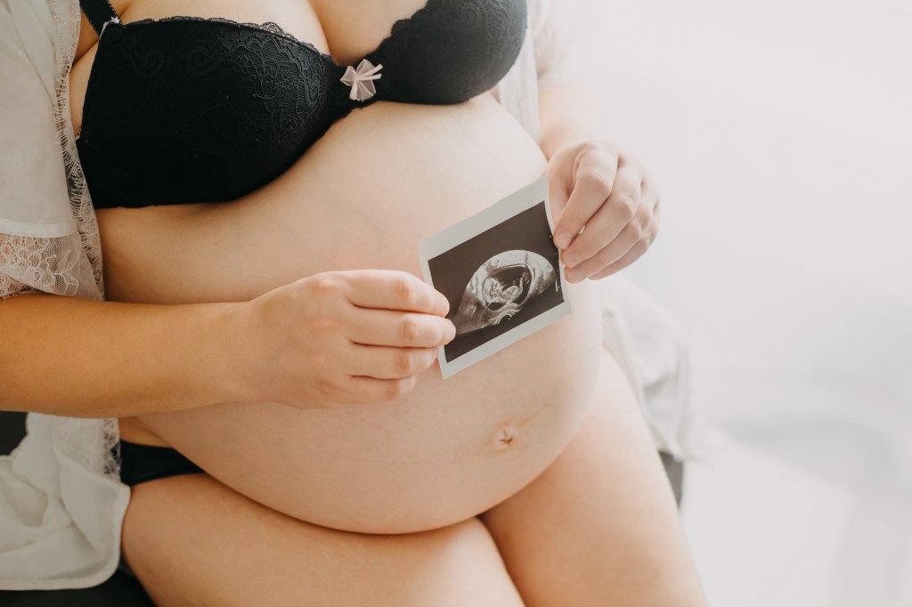 Pregnant mom showing off her ultrasound pic. 