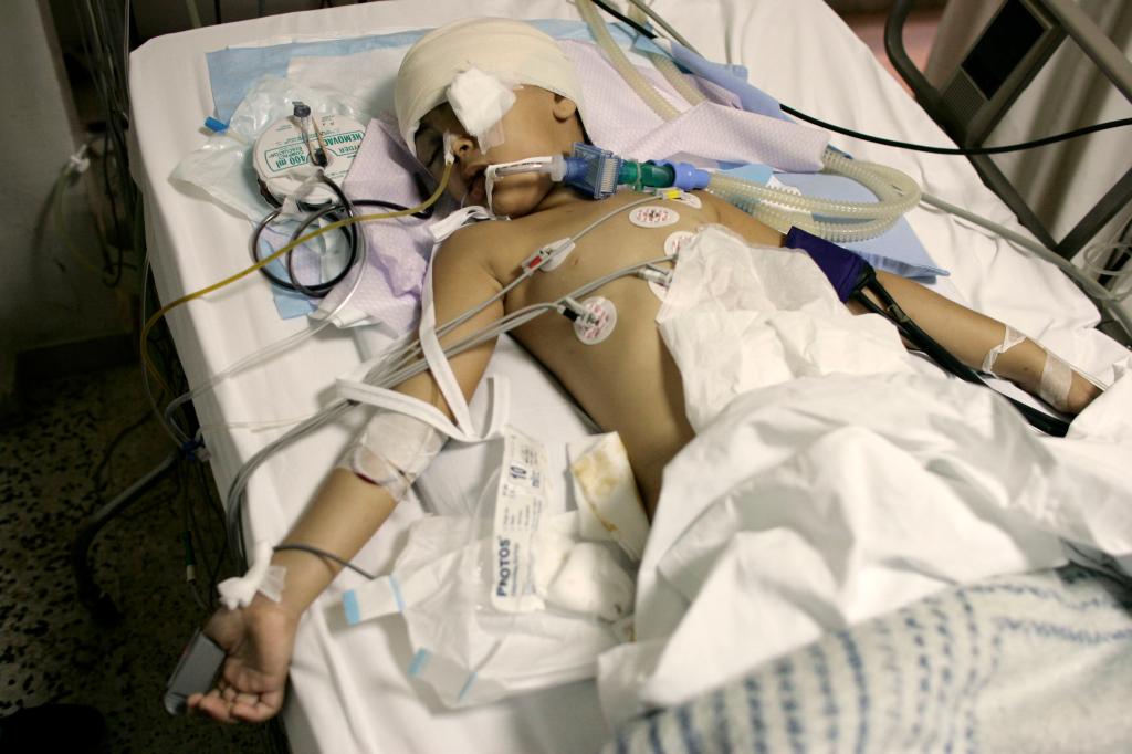 A severly injured 8 year old child lies in Sidon's main hospital after the previous night's bombardment of the city's Palestinian refugee camp Ein El Hilweh.