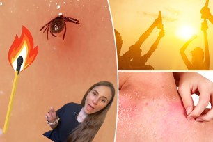 Dr. Andrea Suarez wants you to avoid boozing in the sun, applying sunscreen with poor protection, buying sunscreen with insect repellent, peeling your sunburn, and burning ticks off your skin.