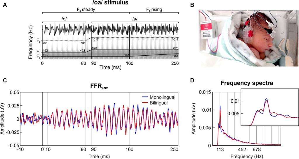 The researchers put electrodes on the babies heads to see how their brains processed certain sounds. 