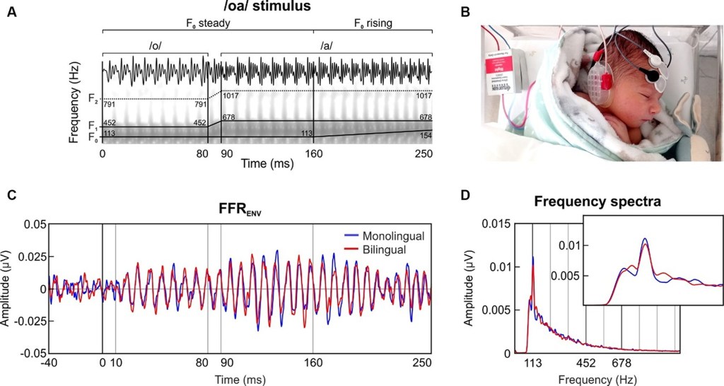 The researchers put electrodes on the babies heads to see how their brains processed certain sounds. 