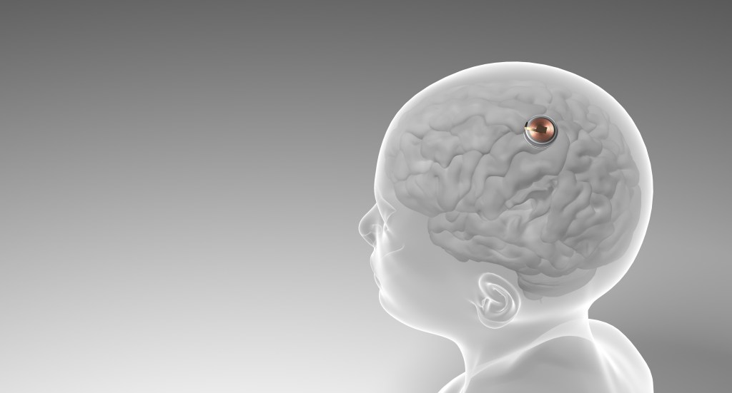 Neuralink brain chip rendering