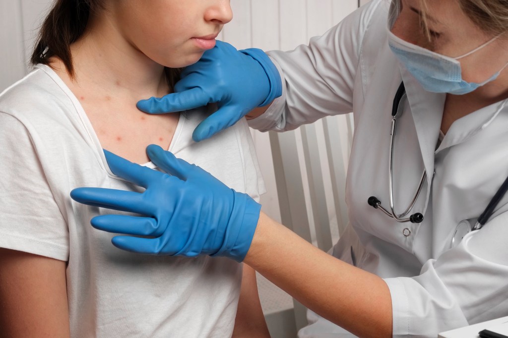 Doctor Checking Skin of Sick Girl. Kid with Red Rash being Examined at the Physician