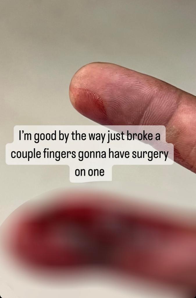 Paul Pierce shows his injured finger on social media. 