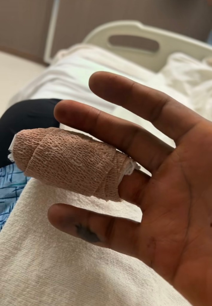 Paul Pierce revealed his gruesome finger injury on Instagram.