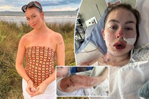 A 23-year-old New Zealand woman is sharing her "terrifying" reaction to medication she took for depression, claiming it "burned me from the inside out" and nearly killed her.