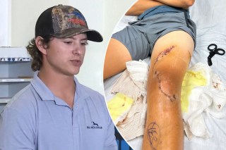 Man attacked in Bahamas’ shark-infested waters talks about traumatic ordeal