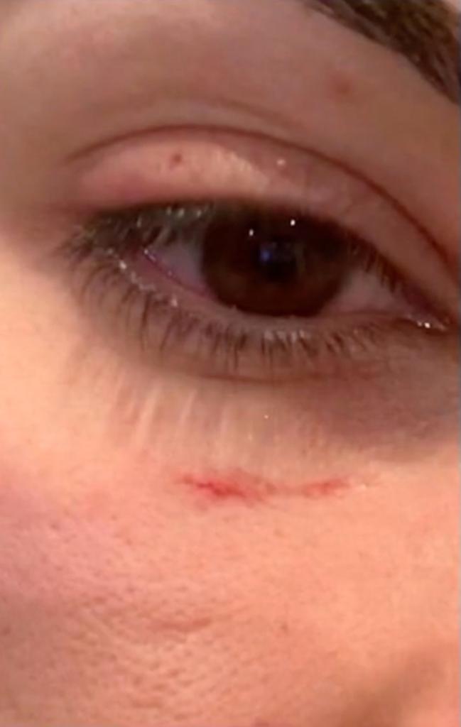 The woman, identified only as Nina, said the perps viciously attacked the couple -- leaving them severely bruised and battered -- in Chicago's Streeterville neighborhood at about 8.30 pm last Friday.