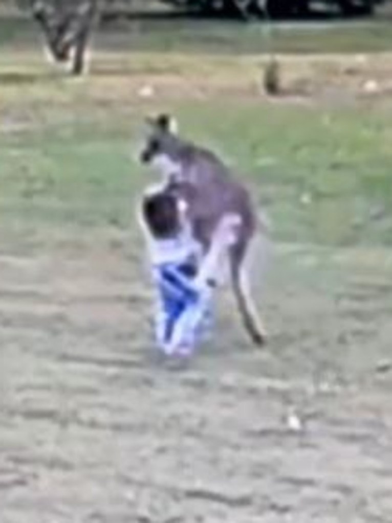 kangaroo attacking child