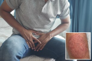 With the arrival of a new, highly contagious fungal infection in NYC, health experts are sharing what you need to know to keep yourself safe.