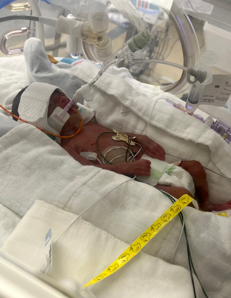 A premature baby who was delivered 24 weeks early and weighed less than two pounds was finally sent home Wednesday after spending 147 days in the neonatal intensive care unit on Long Island. 