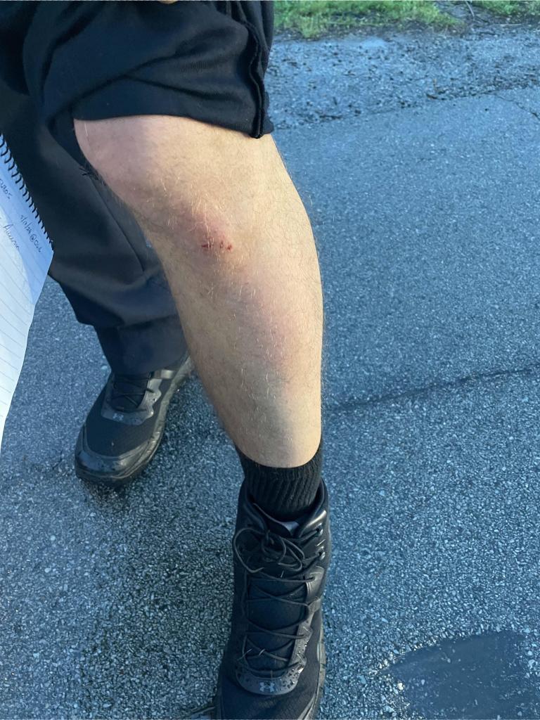 A phot of the officer's leg after the arrest.