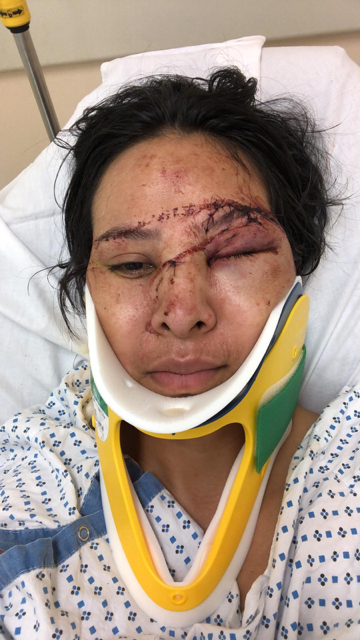 Oralia Perez in her hospital bed.