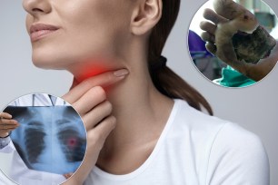 Sore Throat. Closeup Of Beautiful Young Woman Hand Touching Her Ill Neck. Close-up Of Girl Suffering From Throat Pain, Painful Swallowing. Illness, Medicine And Health Care Concept. High Resolution