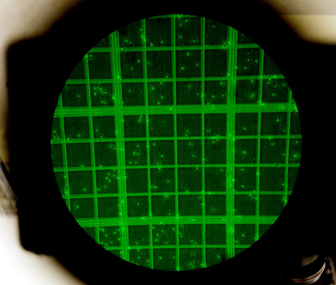 donor sperm seen through a microscope