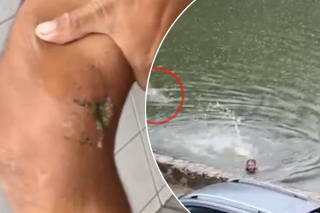 Man vs. croc! Swimmer breaks free after crocodile chomps his leg