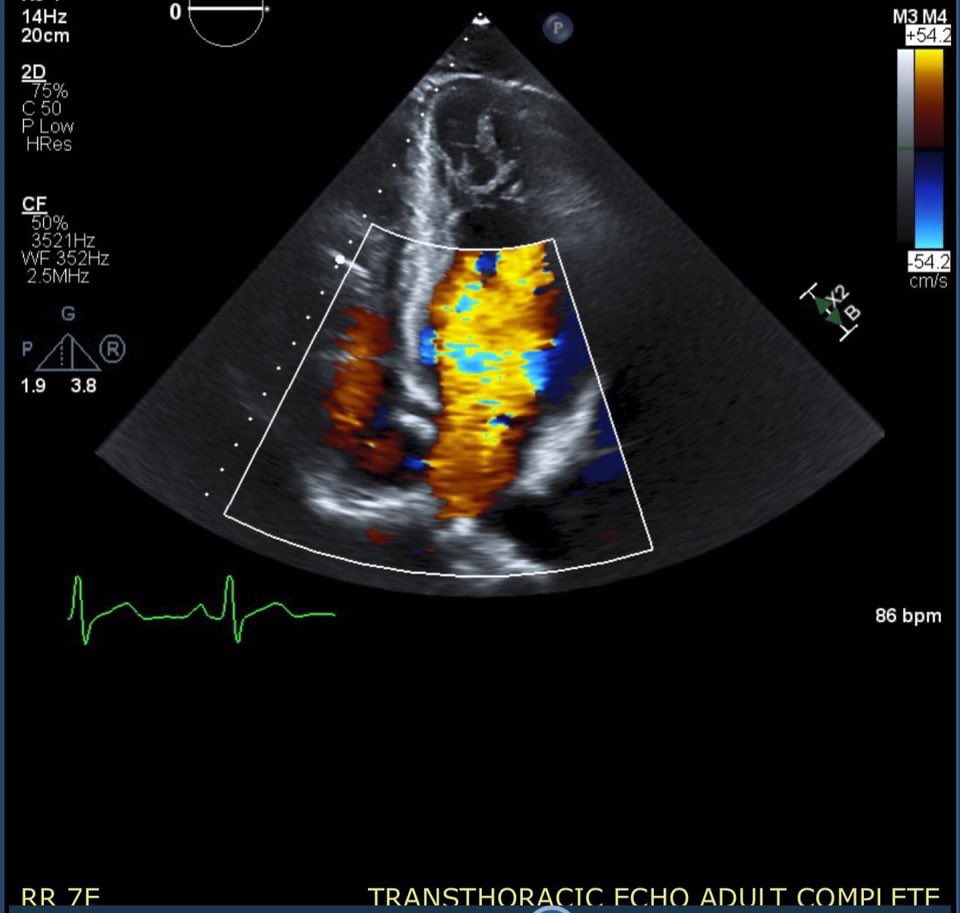 Heart scan.