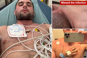 California's Joe DuPont nearly died due to heart failure after doctors mistook his sepsis for anxiety and sent him home.