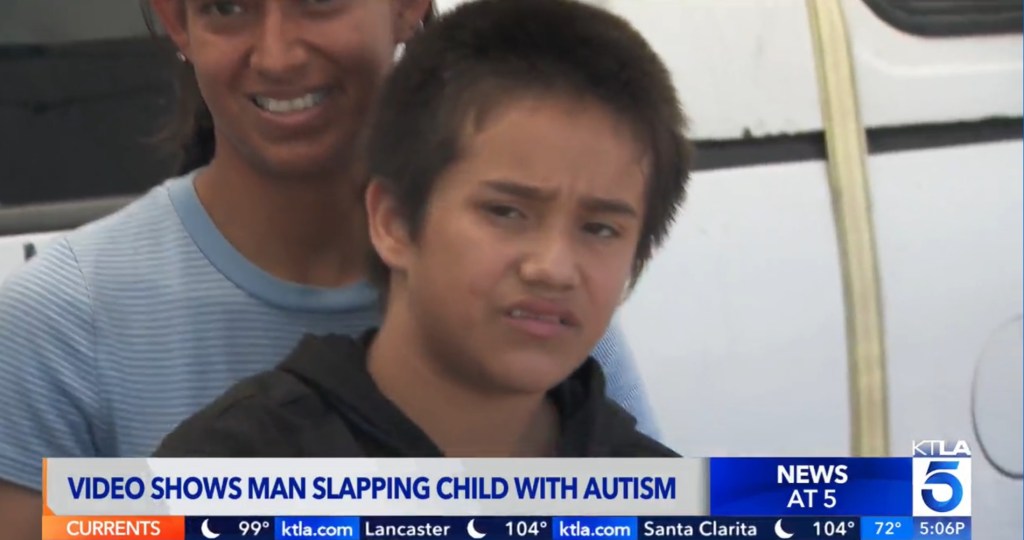 Alfredo's parents said they were angry about the incident and explained because of their son's autism, he often explores the environment around him through touch.