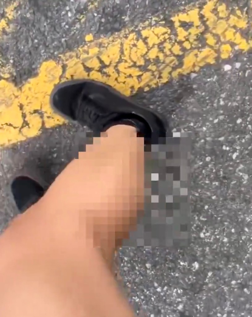 A picture showing the victim's leg, which is blurred where the man ejaculated on her.