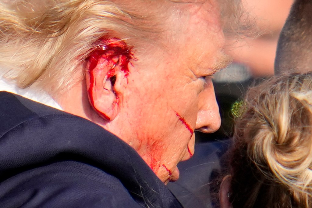 Trump's ear was bloodied.