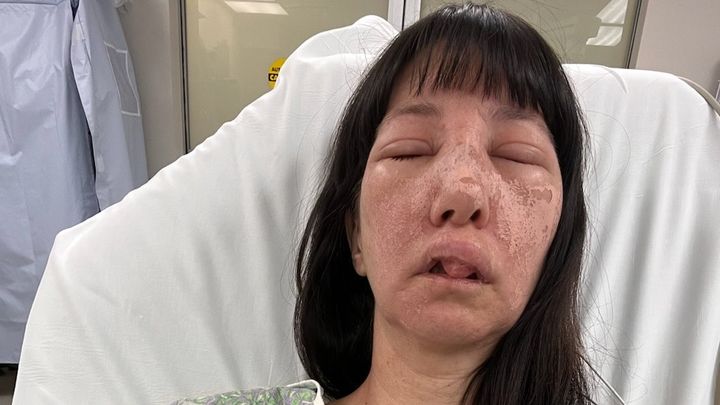 Jessica Rogue lies in a hospital bed with an extremely swollen face