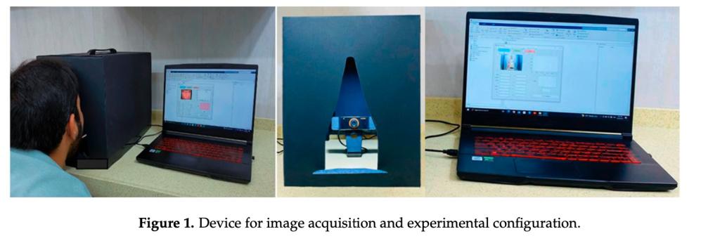 For this study, patients sat about 8 inches from a laptop equipped with a webcam, which took a pic of their tongue. 