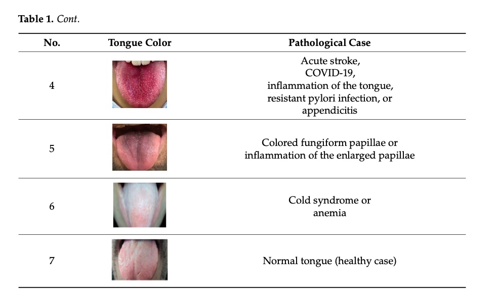 Doctors can learn a lot about a person's health by looking at their tongue.