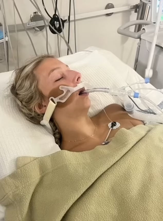 Zara, a blonde white woman, intubated in a hospital bed.