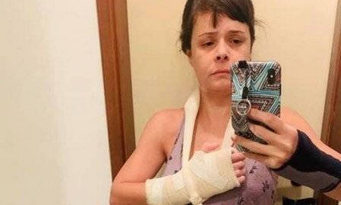 A médica Ticyana: lesões no joelho e mão Foto: Reprodução