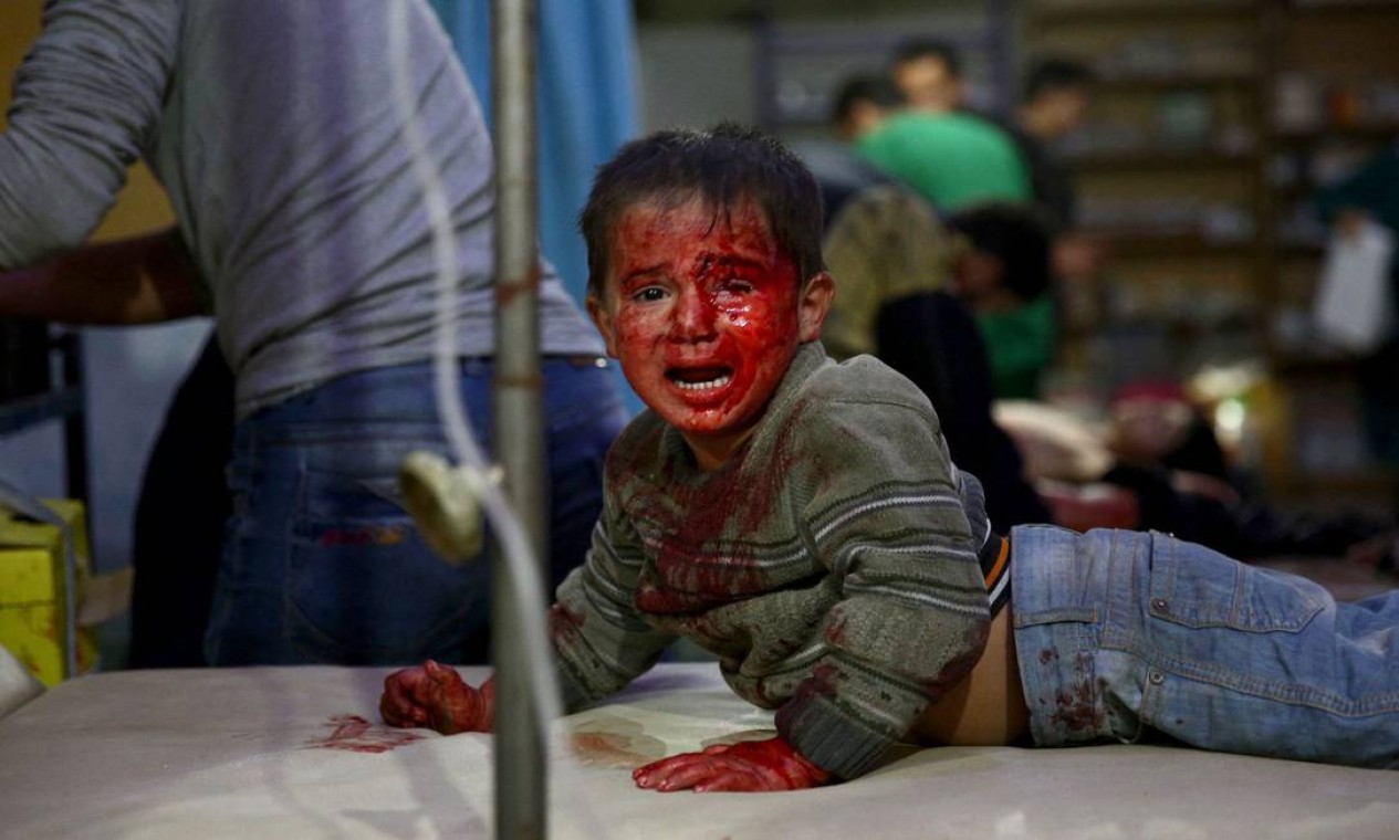 Menino sírio ferido aguarda tratamento em um hospital improvisado após relatos de ataques aéreos por forças do governo na área controlada pelos rebeldes de Douma, a leste da capital Damasco Foto: ABD DOUMANY / AFP - 29/10/2019
