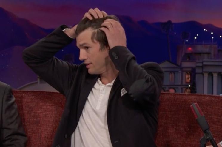 Ashton Kutcher points out his receding hairline