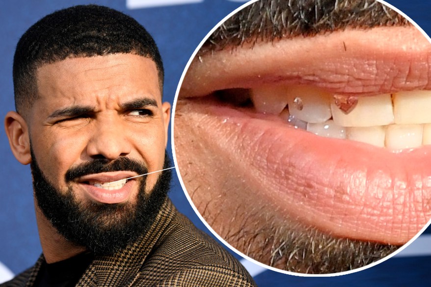 Drake has diamonds in his teeth and more star snaps
