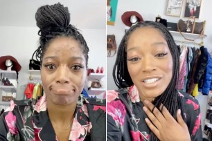 Keke Palmer shared a makeup tutorial video showing fans how she covers her acne breakouts from PCOS.