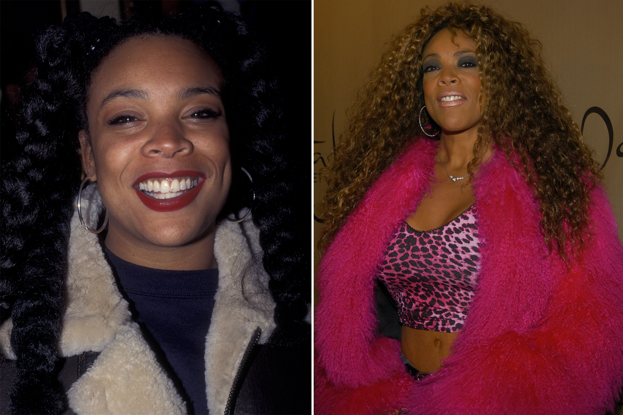 Wendy Williams before and after plastic surgery