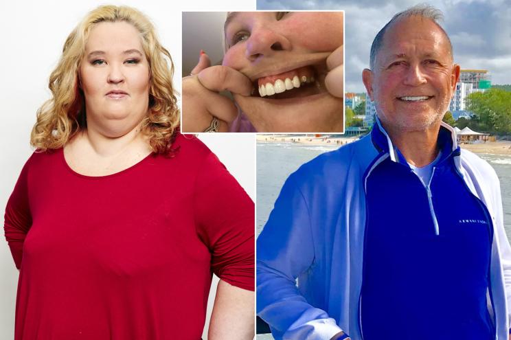 Mama June Shannon, her botched mouth and Dr. Tom Kalili