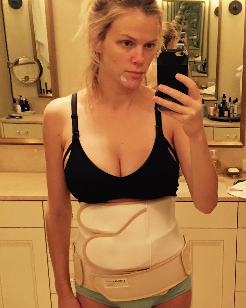 Brooklyn Decker after giving birth.