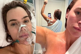 A split photo of Teddi with a breathing mask on and a photo of her showing her back bandages