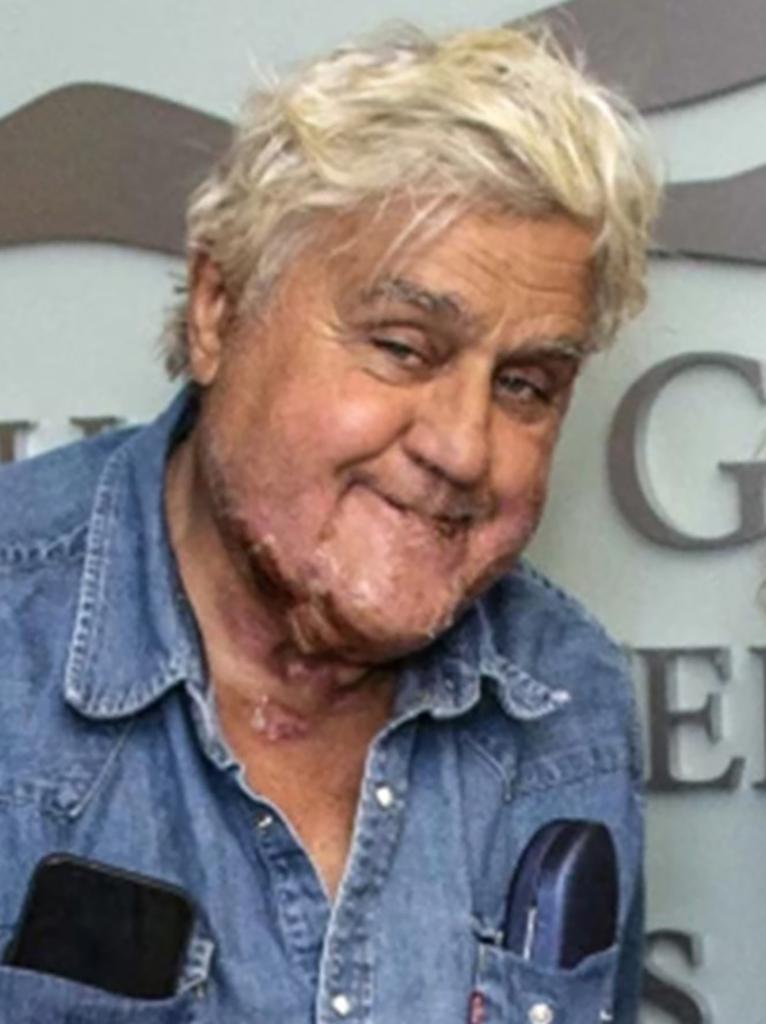 jay leno burns