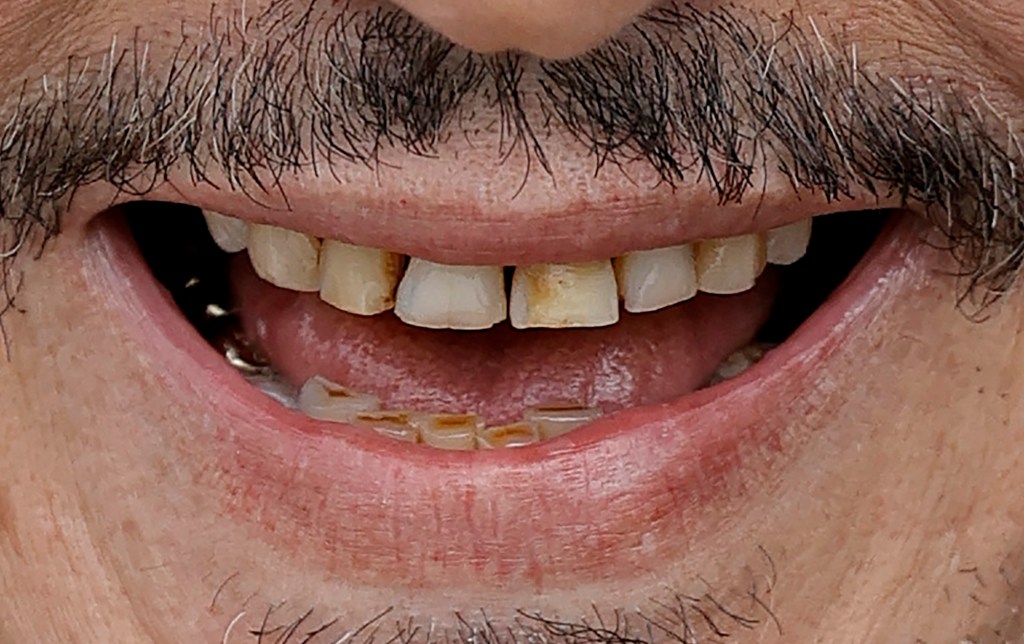 johnny depp brown teeth at cannes 2023