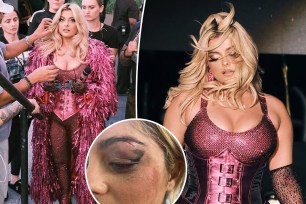 Split images of Bebe Rexha in New York with an inset of her black eye.