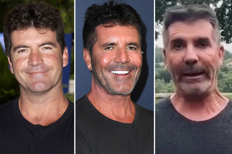 simon cowell's face transformation through the years
