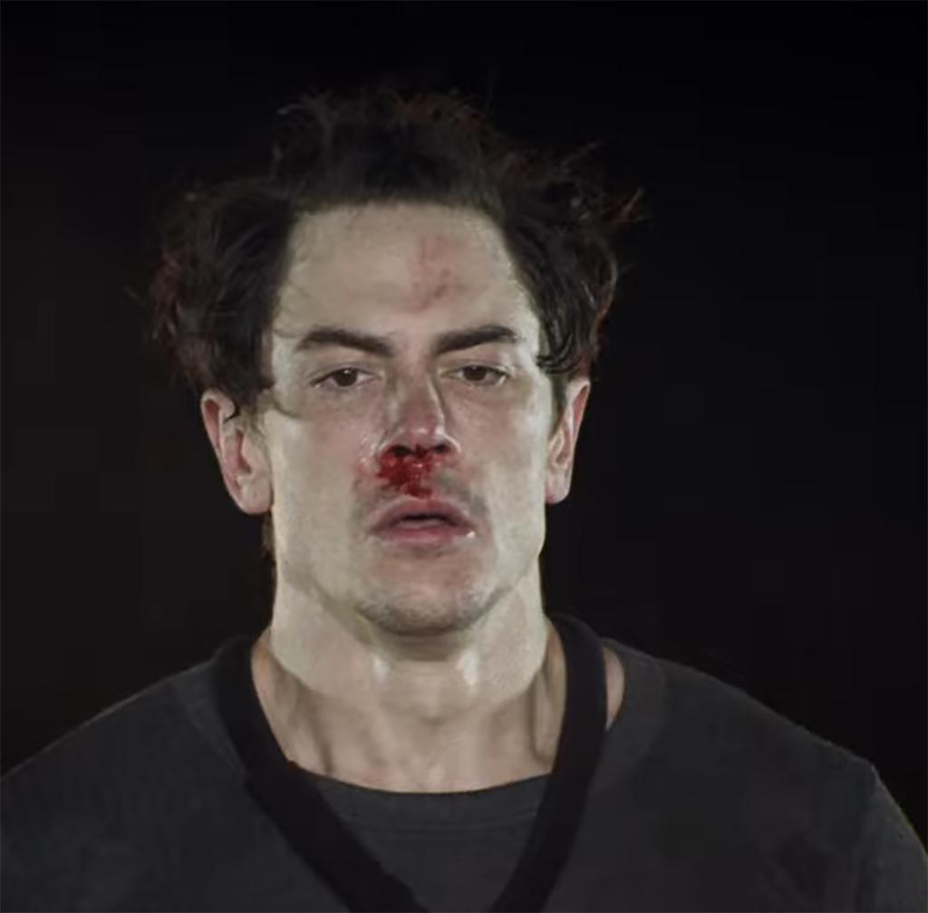 Tom Sandoval with a bloody nose on Special Forces