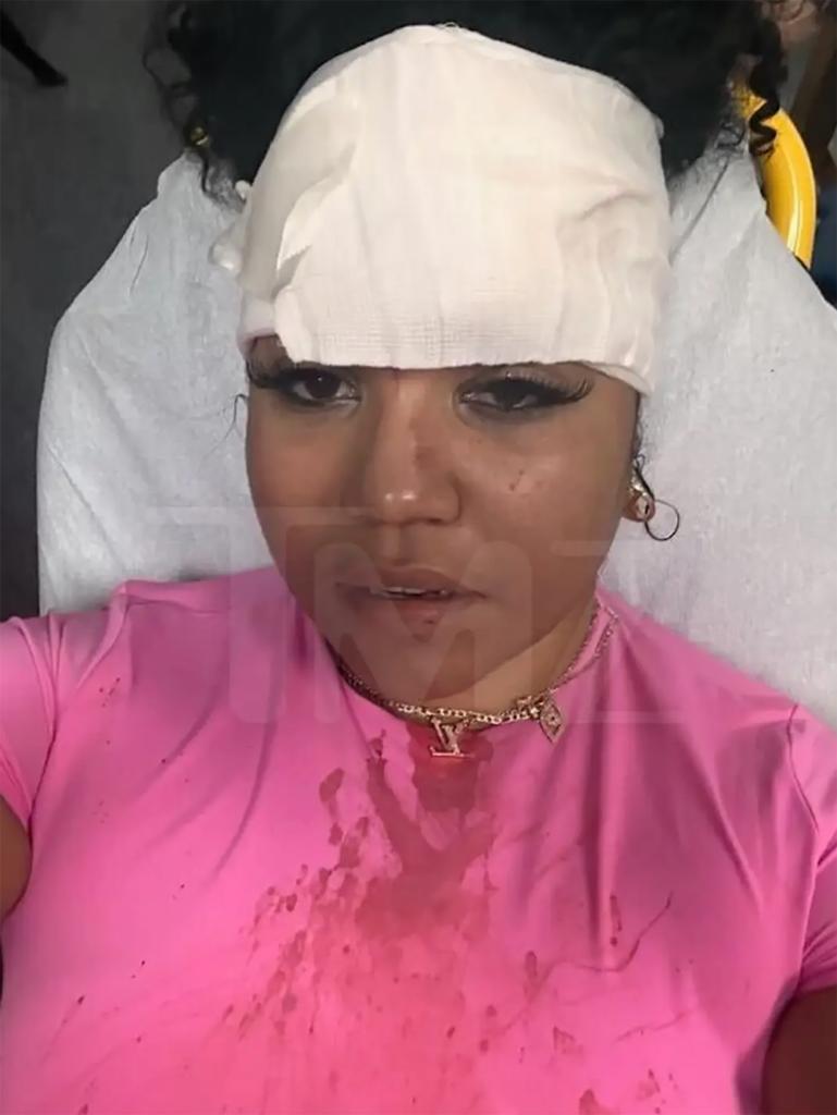 Bryhana Monegain 50 cent injury