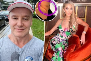 A split photo of a selfie of Lenny Hochstein and Lisa Hochstein posing and a small photo of Lisa Hochstein's bruise