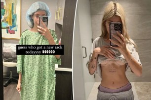 A split photo of a mirror selfie of Sami Sheen in a hospital gown and a mirror selfie of Sami Sheen's markings after her boob job