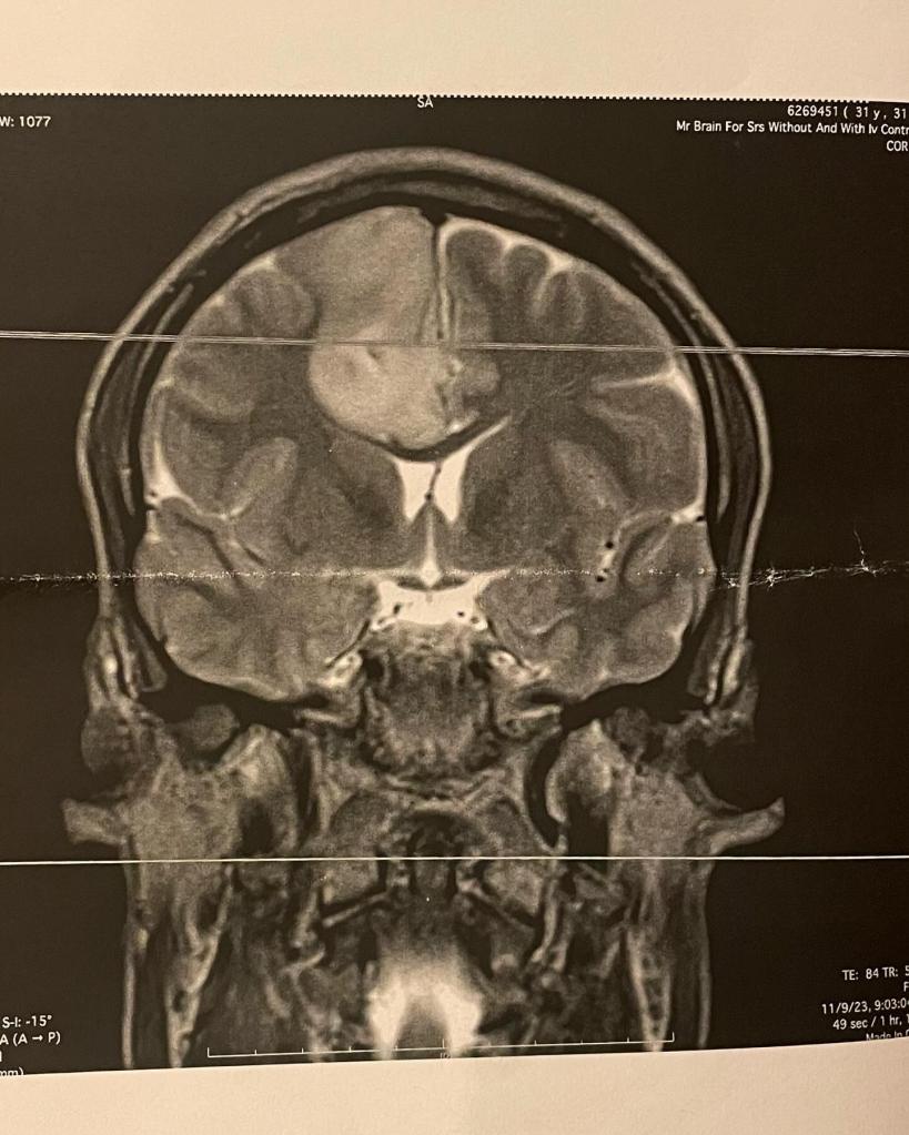 Barton Cowperthwaite's brain scan