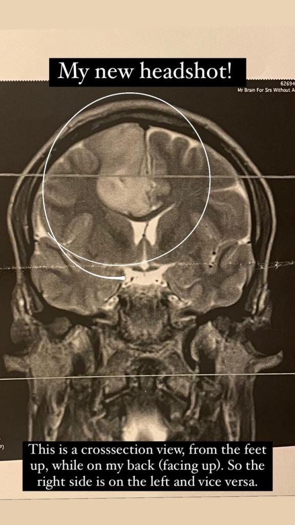 Barton Cowperthwaite's brain scan