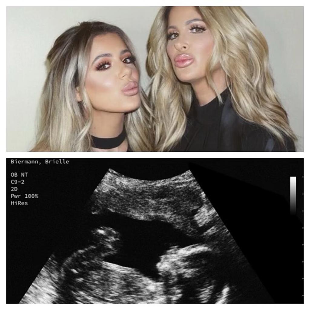 Kim Zolciak's Instagram post showing Brielle Biermann's fake sonogram