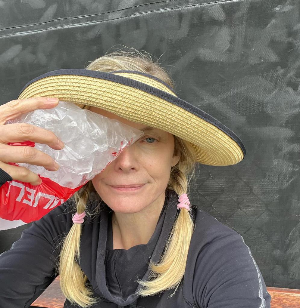 A selfie of Michelle Pfeiffer holding a bag of ice on her eye.